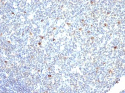 Human IgM Immunoglobulin Monoclonal Mouse Antibody (IM260)