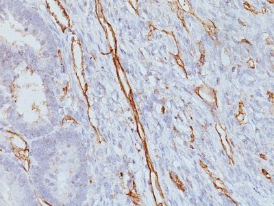 CD31 / PECAM-1 Monoclonal Mouse Antibody (JC/70A)