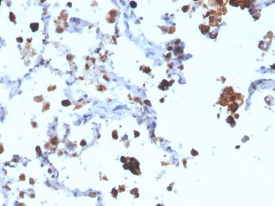 Napsin A Monoclonal Mouse Antibody (NAPSA/3308)