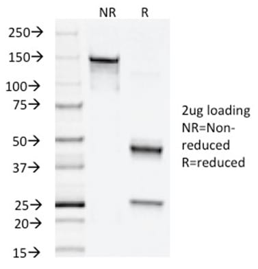 Napsin-A Monoclonal Mouse Antibody (NAPSA/1238)