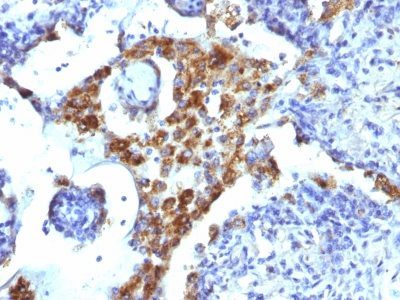 Napsin-A Monoclonal Mouse Antibody (NAPSA/1239)