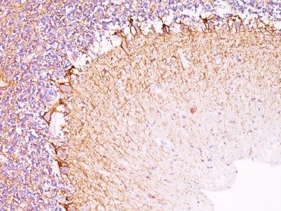 Neurofilament Monoclonal Mouse Antibody (NF421 + NFL/736)