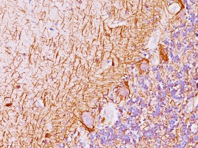 Neurofilament Monoclonal Mouse Antibody (NF421 + NFL/736)