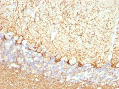 Neurofilament Monoclonal Mouse Antibody (NFL/736)