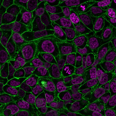 CellBrite® Steady Membrane Staining Kits