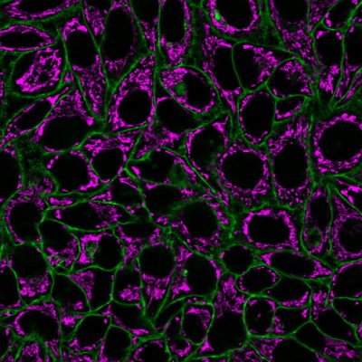 CellBrite® Steady Membrane Staining Kits