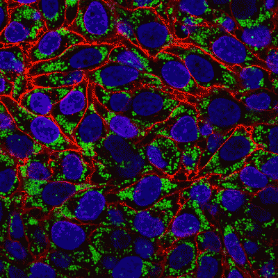 LipidSpot™ Lipid Droplet Stains