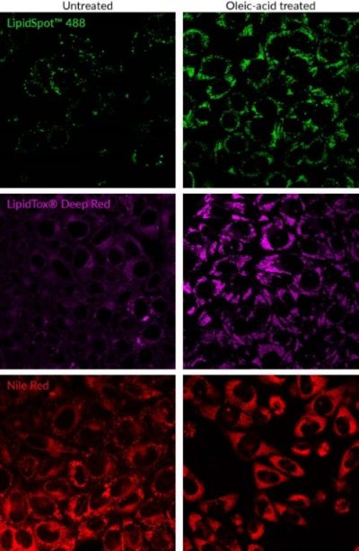 LipidSpot™ Lipid Droplet Stains