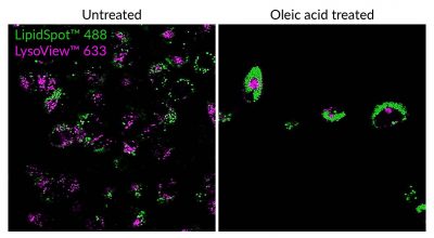 LipidSpot™ Lipid Droplet Stains