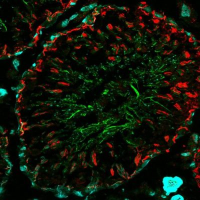 Mix-n-Stain™ CF® Dye Antibody Labeling Kits