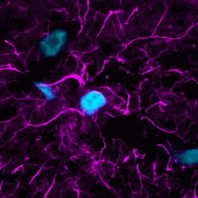 TrueBlack® Lipofuscin Autofluorescence Quencher