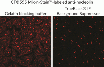 TrueBlack® IF Background Suppressor System (Permeabilizing)