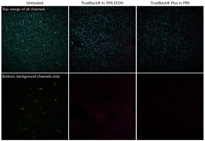 TrueBlack® Plus Lipofuscin Autofluorescence Quencher, 40X in DMSO