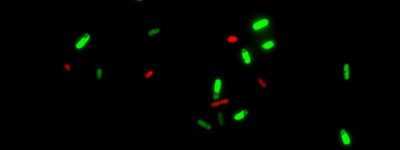 Viability/Cytotoxicity Assay Kit for Bacteria Live & Dead Cells