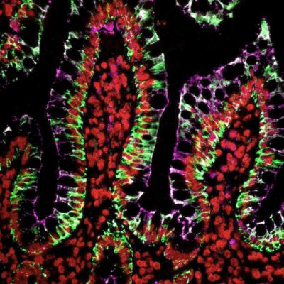 Tyramide Amplification Buffer Plus