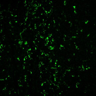 Tyramide Amplification Buffer Plus