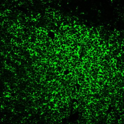 Tyramide Amplification Buffer Plus