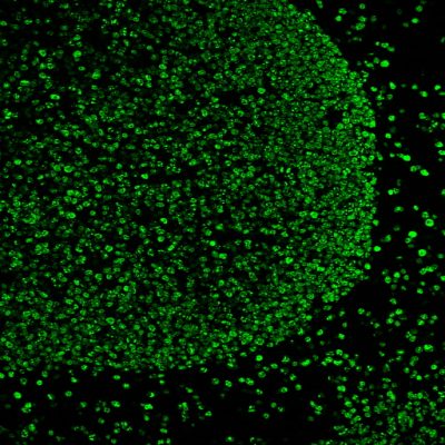 Tyramide Amplification Buffer Plus