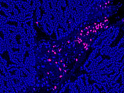 TUNEL Assay Apoptosis Detection Kit