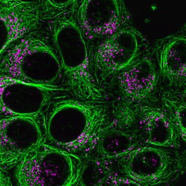 ViaFluor® Live Cell Microtubule Stains