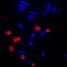 微生物学染色 - 用 DAPI 和 CF633-WGA 染色的大肠杆菌和沙门氏菌共培养物