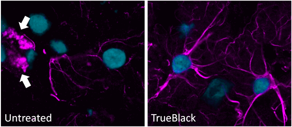 Trueblack CF640R GAR DAPI ihc 复合材料