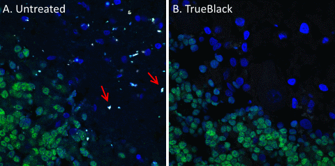 使用 TrueBlack 预处理淬灭脂褐质自发荧光。 甲醛固定的人皮质冷冻切片未经处理 (A) 或用 TrueBlack (B) 处理，然后用 CF488A 抗 NeuN 抗体偶联物（绿色）和 DAPI（蓝色）染色。 在蔡司 LSM700 共聚焦显微镜上的所有通道中对切片进行成像。 脂褐质在所有通道中都发出明亮的荧光，在未经处理的组织 (A) 的合并图像中显示为白点。 TrueBlack 预处理消除了脂褐质自发荧光 (B)，对特定染色的影响可以忽略不计。